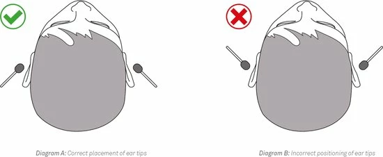 Merkloos Stethoscoop Voor Verpleegkundige - Enkelzijdig - Kleur Zwart - Verpleegster Stethoscoop - Nurse Stethoscope - Afbeelding 6